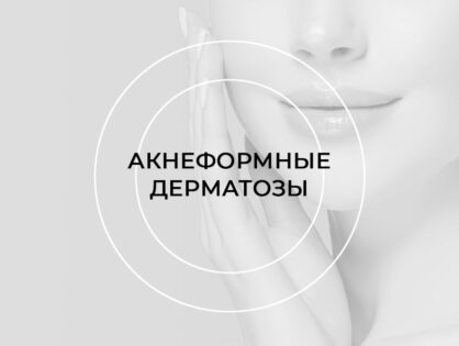 Школа «Акнеформные дерматозы»